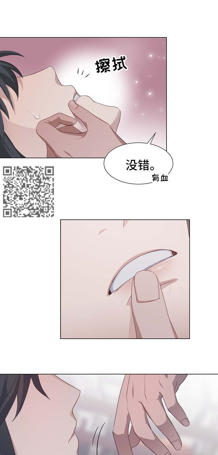 第38章：受损4