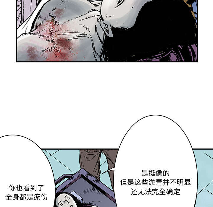 第23章：尸检的可疑之处4